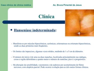 Clínica Hanseníase indeterminada :   -  Manifesta-se por máculas hipocrômicas, acrômicas, eritematosas ou eritemato-hipocrômicas, sendo as duas primeiras mais freqüentes.  -  Os limites são imprecisos, algumas vezes nítidos, medindo de 1 a 5 cm de diâmetro.  -  O número de início é de uma ou duas manchas, localizadas principalmente nas nádegas, coxas e região deltoidiana e quanto maior o número de manchas, pior é o prognóstico. -  Há alteração da sensibilidade, vasomotora e da sudorese por acometimento de filetes nervosos, com alopécia parcial. Pode ocorrer evolução para as três outras formas clínicas. Caso clínico de clínica médica  Ac. Bruna Pimentel de Jesus 