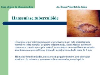 Hanseníase tuberculóide   -  Evidencia-se por micropápulas que se desenvolvem em pele aparentemente normal ou sobre manchas do grupo indeterminado. Essas pápulas podem ser pouco mais coradas que a pele normal, acastanhadas ou vermelho-acastanhadas, acuminadas ou semi-esféricas, tendendo a coalescer medindo cerca de 2 mm.  -  Há placas bem delimitadas, únicas ou em pequeno número, com alterações sensitivas, de sudorese e vasomotoras bem acentuadas, com alopécia.  Caso clínico de clínica médica  Ac. Bruna Pimentel de Jesus 
