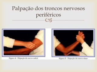 Palpação dos troncos nervosos
         periféricos
             
 
