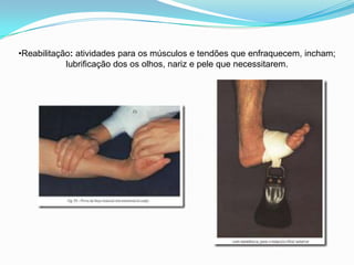 •Reabilitação: atividades para os músculos e tendões que enfraquecem, incham;
lubrificação dos os olhos, nariz e pele que necessitarem.
 