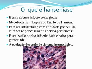 O que é hanseníase
 È uma doença infecto contagiosa;
 Mycobacterium Leprae ou Bacilo de Hansen;
 Parasita intracelular, com afinidade por células
cutâneas e por células dos nervos periféricos;
 É um bacilo de alta infectividade e baixa pato-
genicidade;
 A evolução depende do sistema imunológico.
 