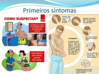 Primeiros sintomas
 