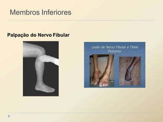 Membros Inferiores
Palpação do Nervo Fíbular
 