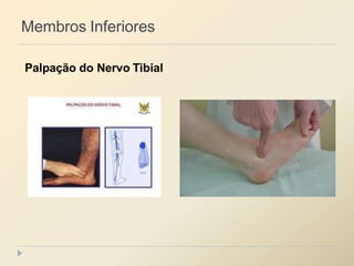 Membros Inferiores
Palpação do Nervo Tibial
 