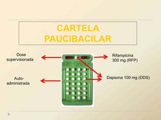 Rifampicina
300 mg (RFP)
Dapsona 100 mg (DDS)
Dose
supervisionada
Auto-
administrada
CARTELA
PAUCIBACILAR
 