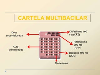 Rifampicina
300 mg
(RFP)
Clofazimina 100
mg (CFZ)
Dapsona 100 mg
(DDS)
Dose
supervisionada
Auto-
administrada
Clofazimina
CARTELA MULTIBACILAR
 