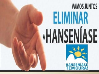 Hanseníase
