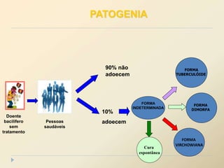 Doente
bacilífero
sem
tratamento
Pessoas
saudáveis
90% não
adoecem
10%
adoecem
Cura
FORMA
TUBERCULÓIDE
FORMA
DIMORFA
FORMA
VIRCHOWIANA
Cura
espontânea
FORMA
INDETERMINADA
PATOGENIA
 