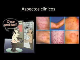 Aspectos clínicos
 
