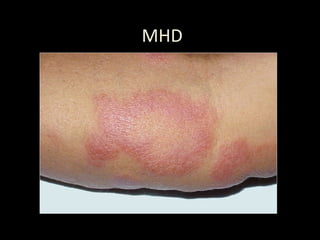 MHD
 