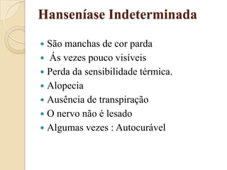 Hanseníase Indeterminada
São manchas de cor parda
 Ás vezes pouco visíveis
 Perda da sensibilidade térmica.
 Alopecia
 Ausência de transpiração
 O nervo não é lesado
 Algumas vezes : Autocurável


 