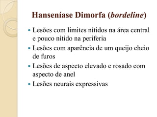 Hanseníase Dimorfa (bordeline)
Lesões com limites nítidos na área central
e pouco nítido na periferia
 Lesões com aparência de um queijo cheio
de furos
 Lesões de aspecto elevado e rosado com
aspecto de anel
 Lesões neurais expressivas


 