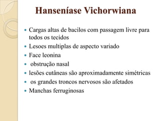 Hanseníase Vichorwiana








Cargas altas de bacilos com passagem livre para
todos os tecidos
Lesoes multiplas de aspecto variado
Face leonina
obstrução nasal
lesões cutâneas são aproximadamente simétricas
os grandes troncos nervosos são afetados
Manchas ferruginosas

 