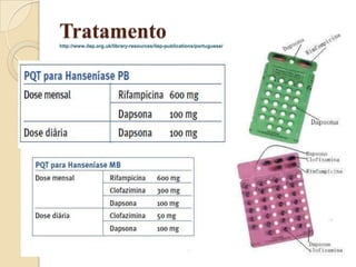 Tratamento
http://www.ilep.org.uk/library-resources/ilep-publications/portuguese/

 