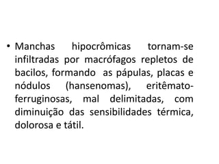 • Manchas hipocrômicas tornam-se
infiltradas por macrófagos repletos de
bacilos, formando as pápulas, placas e
nódulos (hansenomas), eritêmato-
ferruginosas, mal delimitadas, com
diminuição das sensibilidades térmica,
dolorosa e tátil.
 
