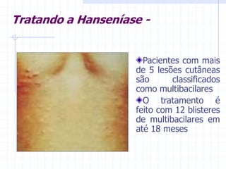 Tratando a Hanseníase -
Pacientes com mais
de 5 lesões cutâneas
são classificados
como multibacilares
O tratamento é
feito com 12 blisteres
de multibacilares em
até 18 meses
 