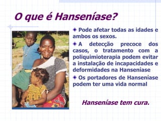O que é Hanseníase?
Pode afetar todas as idades e
ambos os sexos.
A detecção precoce dos
casos, o tratamento com a
poliquimioterapia podem evitar
a instalação de incapacidades e
deformidades na Hanseníase
Os portadores de Hanseníase
podem ter uma vida normal
Hanseníase tem cura.
 