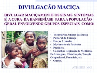 DIVULGAÇÃO MACIÇA
DIVULGAR MACIÇAMENTE OS SINAIS, SINTOMAS
E A CURA DA HANSENÍASE PARAA POPULAÇÃO
GERAL ENVOLVENDO GRUPOS ESPECIAIS COMO:
 Voluntários Amigos da Escola
• Pastoral da Criança
• Forças Armadas
• Movimento de Pacientes
• Presídios
• Conselhos Regionais de Medicina,
Enfermagem, Fisioterapia, Terapia
Ocupacional, Farmácia, etc
• Outros.
ATH/SES_MG
 