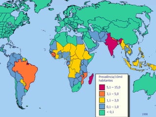 Prevalência/10mil
habitantes
5,1 – 15,0
3,1 – 5,0
1,1 – 3,0
0,1 – 1,0
< 0,1
1998
 