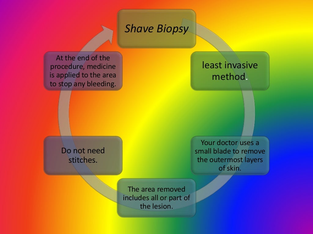 Hansen disease medical microbiology presentation by Ruth Naomi Manuel