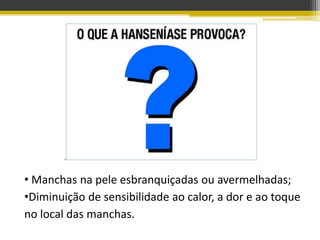 • Manchas na pele esbranquiçadas ou avermelhadas;
•Diminuição de sensibilidade ao calor, a dor e ao toque
no local das manchas.
 