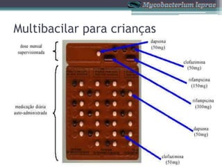 Multibacter Bula Hanseniase mycobacteruim leprae | PPTX