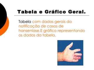 Tabela e Gráfico Geral. Tabela  com dados gerais da notificação de casos de hanseníase.E gráfico representando os dados da tabela. 
