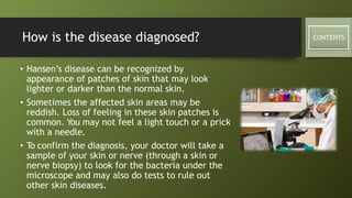 Hansen’s disease (leprosy) | PPTX