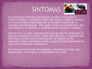 Los primeros síntomas se parecen mucho a una gripe e incluyen fiebre, escalofríos, dolor de cabeza y dolores severos en los músculos, especialmente en la parte inferior de la espalda y en las piernas. Hay dolor severo en el abdomen, las coyunturas y la espalda, y, posiblemente, nausea y vómitos.Dentro de 1 a 5 días después del comienzo de los síntomas, la persona empezará a toser, sentir falta de aire, y respirará con dificultad a causa de la acumulación de líquido en los pulmones. Esta condición puede progresar hasta amenazar la vida con un fracaso respiratorio.Es raro que haya dolor de garganta, chorrera de nariz, ojos lagrimosos, estornudos, o erupciones en la piel. SÍNTOMAS