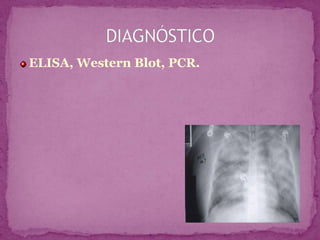 ELISA, Western Blot, PCR.DIAGNÓSTICO