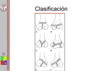Clasificación
 