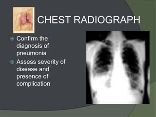 CHEST RADIOGRAPH
 Confirm the
  diagnosis of
  pneumonia
 Assess severity of
  disease and
  presence of
  complication
 