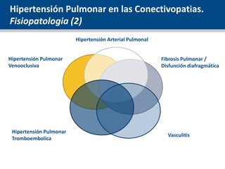 Hipertensión Pulmonar en las Conectivopatias.
Fisiopatologia (2)
Hipertensión Pulmonar
Venooclusiva
Vasculitis
Hipertensió...