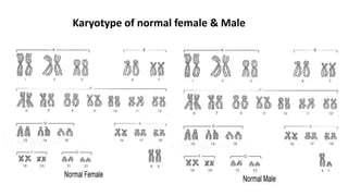 Karyotype of normal female & Male
 