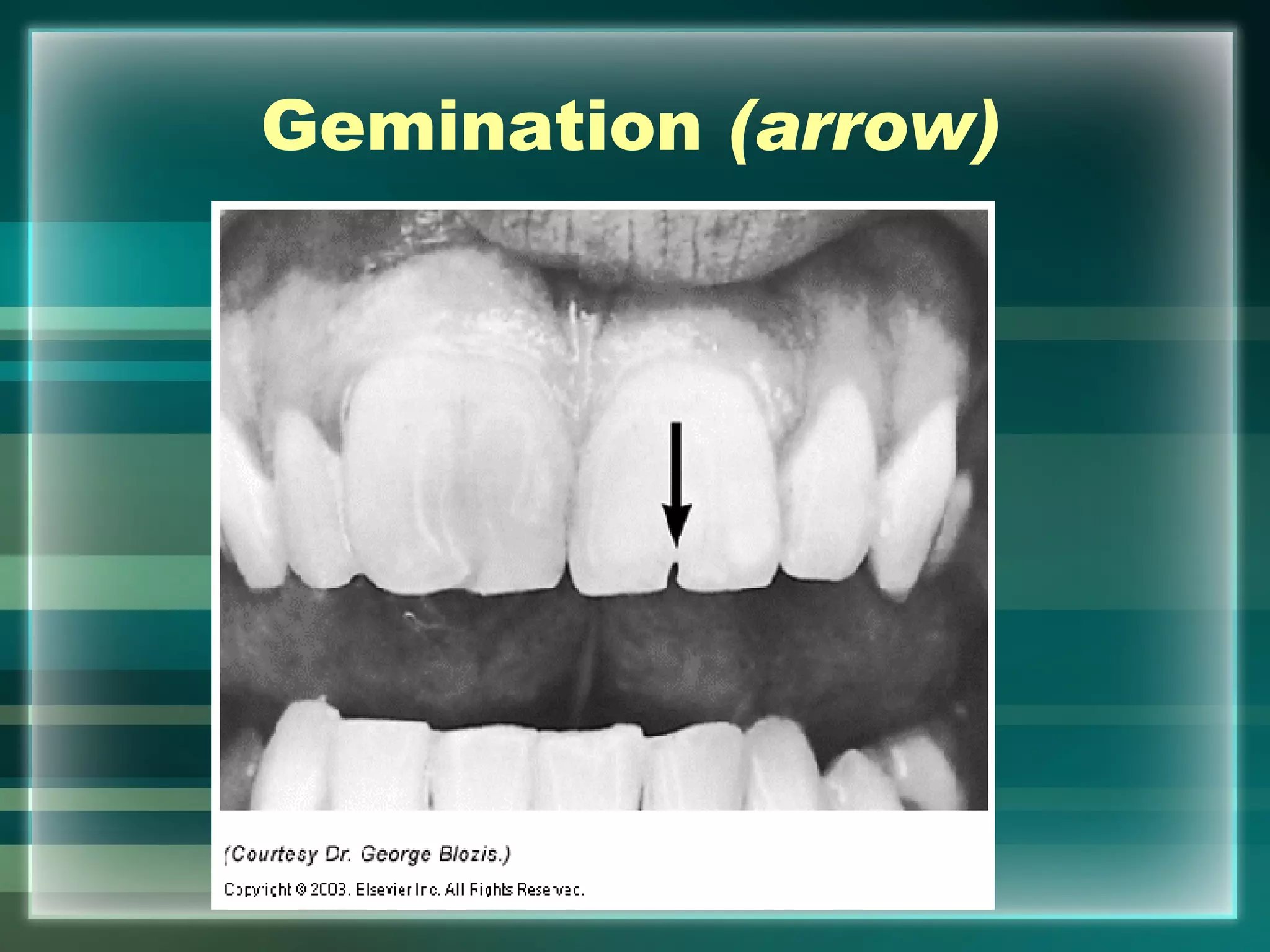 Hard Tissue Charting | PPT