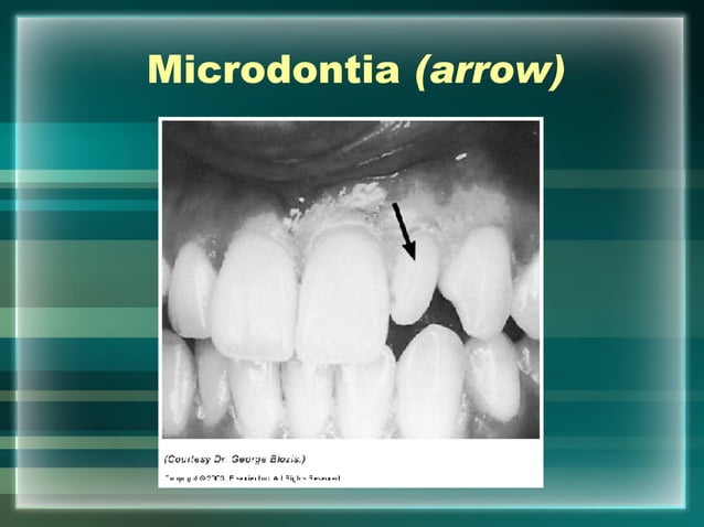 Hard Tissue Charting | PPT | Dental Health | Diseases and Conditions