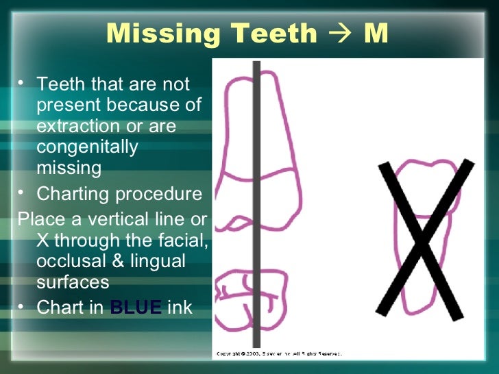 hard tissue charting tooth charting symbols