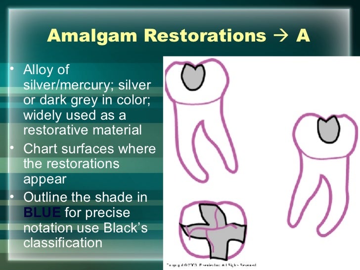 hard tissue charting dental restoration charting