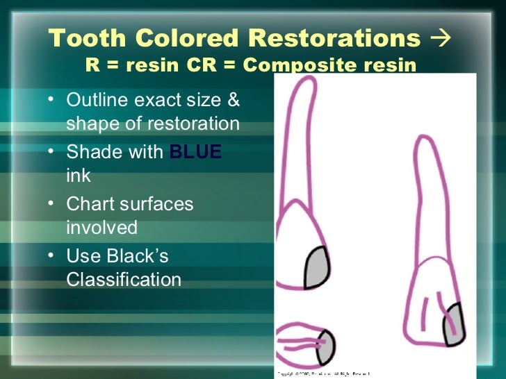 hard tissue charting dental restoration charting