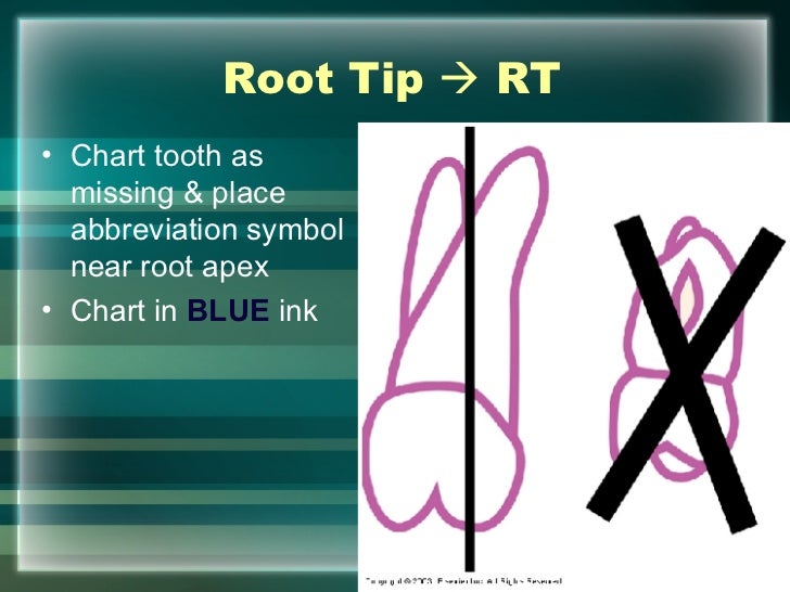hard tissue charting odontogram charting symbols