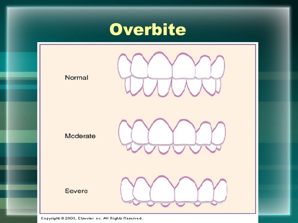 Hard Tissue Charting