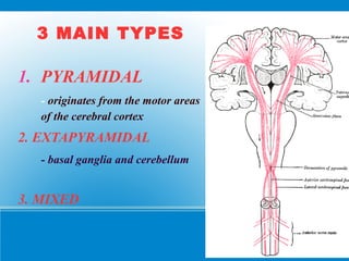 3 MAIN TYPES
1. PYRAMIDAL
- originates from the motor areas
of the cerebral cortex
2. EXTAPYRAMIDAL
- basal ganglia and cerebellum
3. MIXED
 