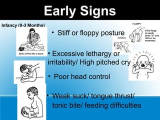 Early Signs
• Stiff or floppy posture
• Weak suck/ tongue thrust/
tonic bite/ feeding difficulties
• Poor head control
• Excessive lethargy or
irritability/ High pitched cry
Infancy (0-3 Months)
 