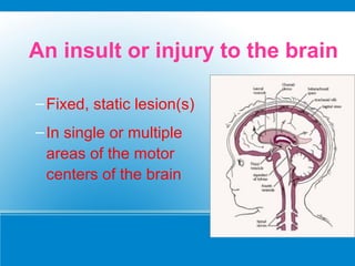 An insult or injury to the brain
–Fixed, static lesion(s)
–In single or multiple
areas of the motor
centers of the brain
 