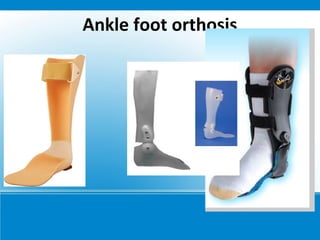 Ankle foot orthosis
 
