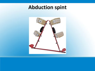 Abduction spint
 