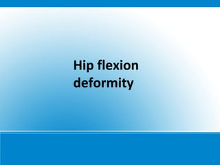 Hip flexion
deformity
 