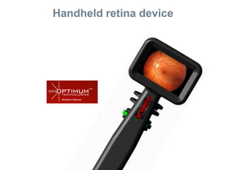 Handheld retina device
 