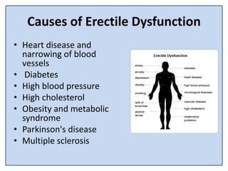 Causes of Erectile Dysfunction
• Heart disease and
narrowing of blood
vessels
• Diabetes
• High blood pressure
• High cholesterol
• Obesity and metabolic
syndrome
• Parkinson's disease
• Multiple sclerosis
 