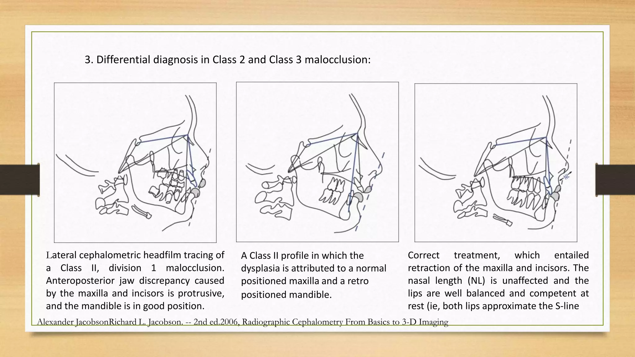 HARD TISSUE CEPHALOMETRIC ANALYSIS.pptx